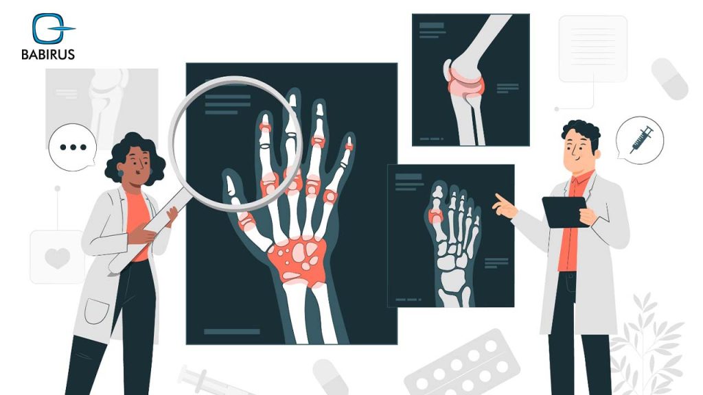 Understanding Rheumatology: A Full Guide | Babirus LLC