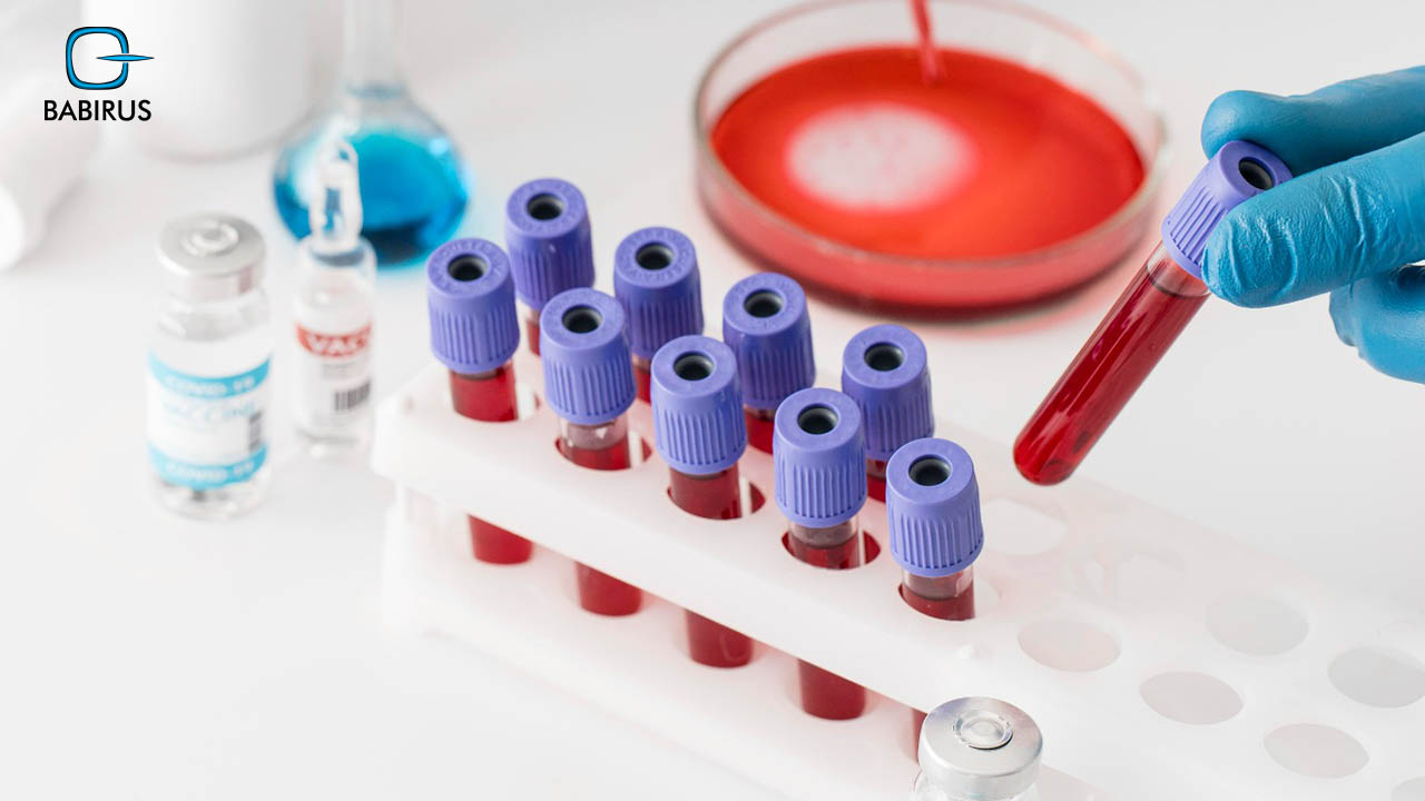 Understanding Complete Blood Count (CBC) Tests | Babirus LLC