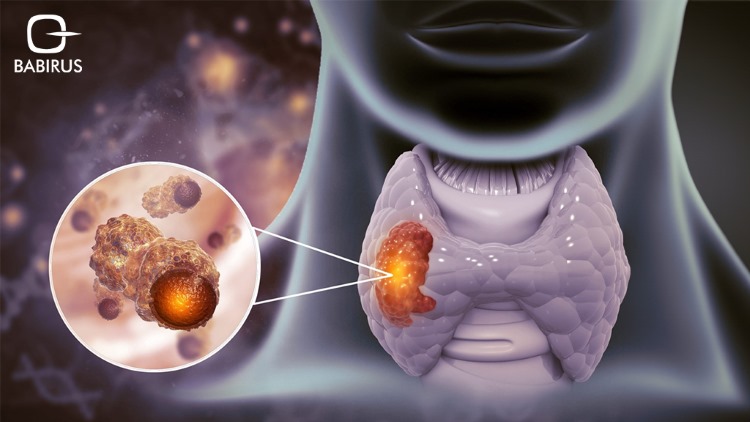 Cytopathology in Thyroid and Breast Diseases