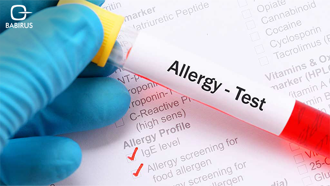 The Science Behind Allergy Testing